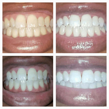 VARO™ On-The-Go Whitening Pen
