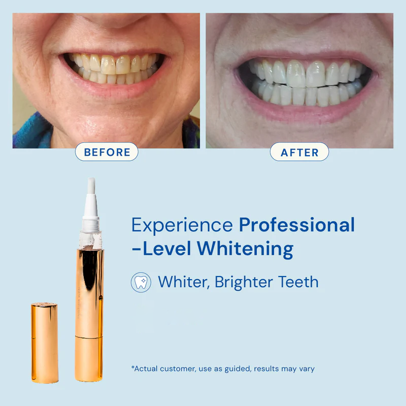 VARO™ On-The-Go Whitening Pen